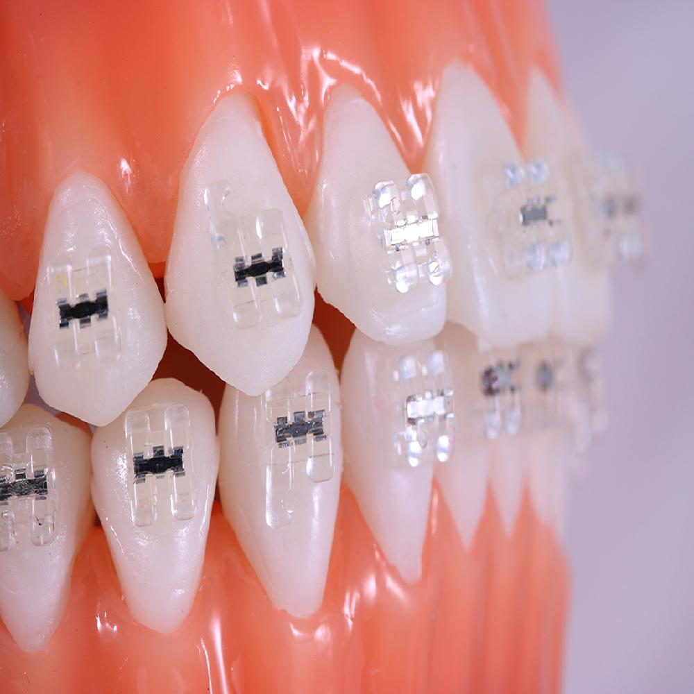 LUCID (Resin Bracket)